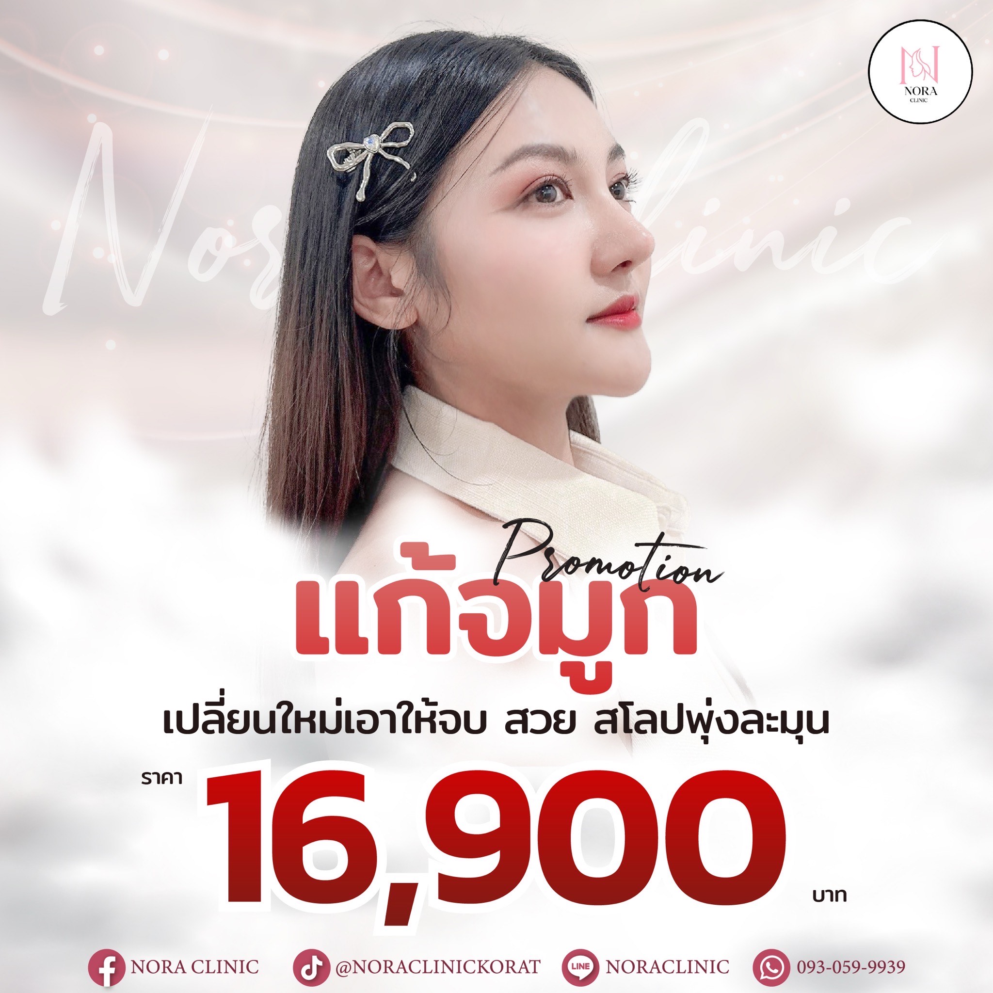 Hot Promotion โปรแก้จมูก